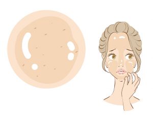 Skin trouble with a woman